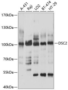 Desmocollin 2 Antibody in Western Blot (WB)