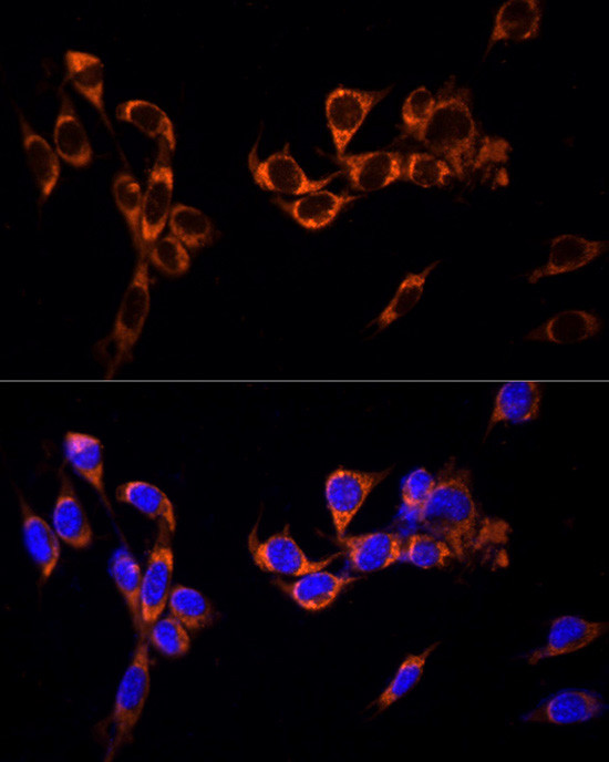 GPR30 Antibody in Immunocytochemistry (ICC/IF)