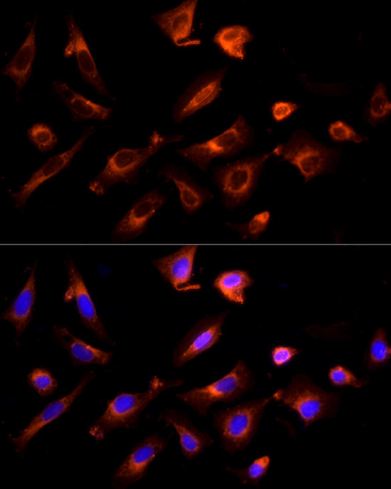 GPR30 Antibody in Immunocytochemistry (ICC/IF)