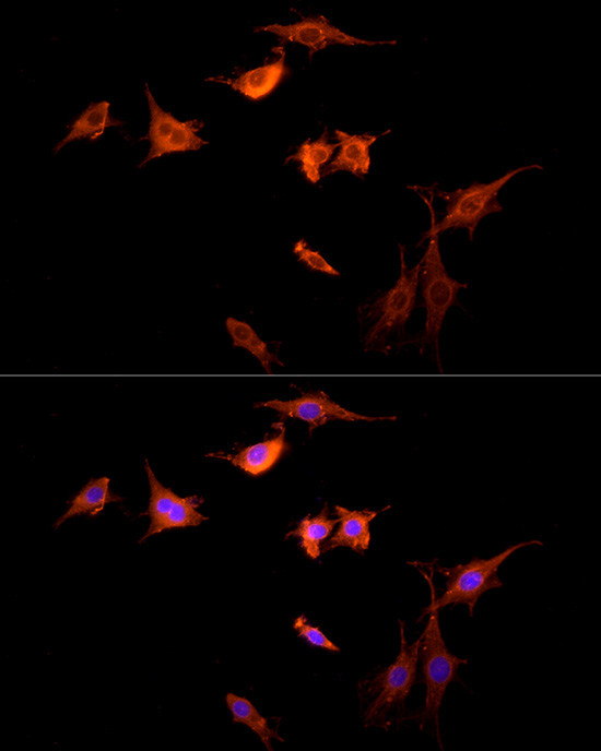 GPR30 Antibody in Immunocytochemistry (ICC/IF)