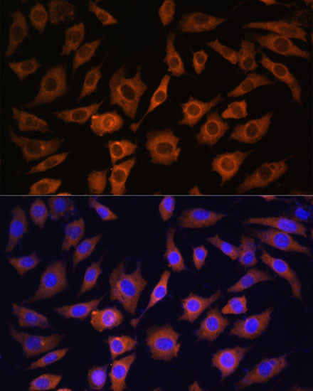 14-3-3 beta Antibody in Immunocytochemistry (ICC/IF)