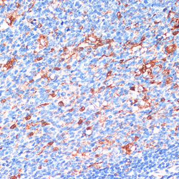 14-3-3 beta Antibody in Immunohistochemistry (Paraffin) (IHC (P))