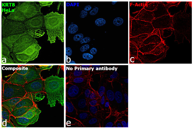 Cytokeratin 8 Antibody in Immunocytochemistry (ICC/IF)