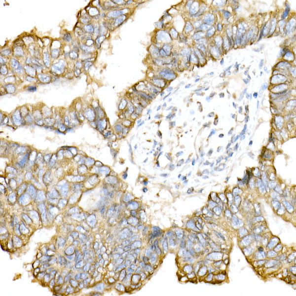 Cytokeratin 8 Antibody in Immunohistochemistry (Paraffin) (IHC (P))