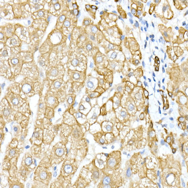 Cytokeratin 8 Antibody in Immunohistochemistry (Paraffin) (IHC (P))