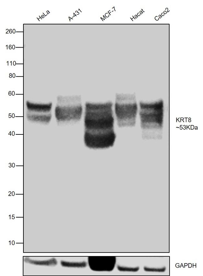 Cytokeratin 8 Antibody in Western Blot (WB)