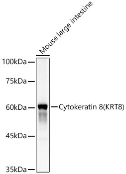 Cytokeratin 8 Antibody in Western Blot (WB)