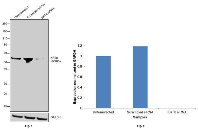 Cytokeratin 8 Antibody in Western Blot (WB)