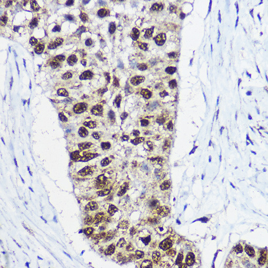 SMARCA1 Antibody in Immunohistochemistry (Paraffin) (IHC (P))