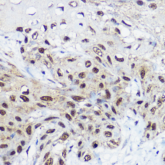 SMARCA1 Antibody in Immunohistochemistry (Paraffin) (IHC (P))