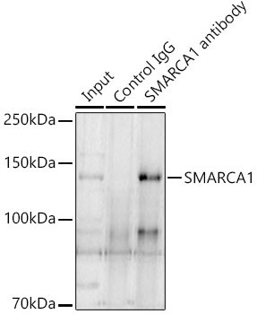 SMARCA1 Antibody in Immunoprecipitation (IP)