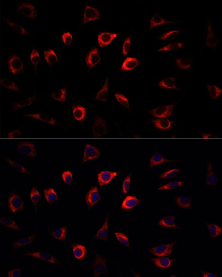 SGK1 Antibody in Immunocytochemistry (ICC/IF)