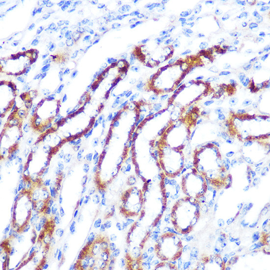 SGK1 Antibody in Immunohistochemistry (Paraffin) (IHC (P))