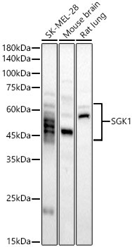 SGK1 Antibody in Western Blot (WB)