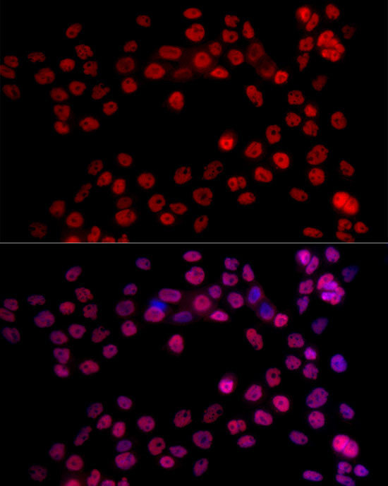 NR2F2 Antibody in Immunocytochemistry (ICC/IF)