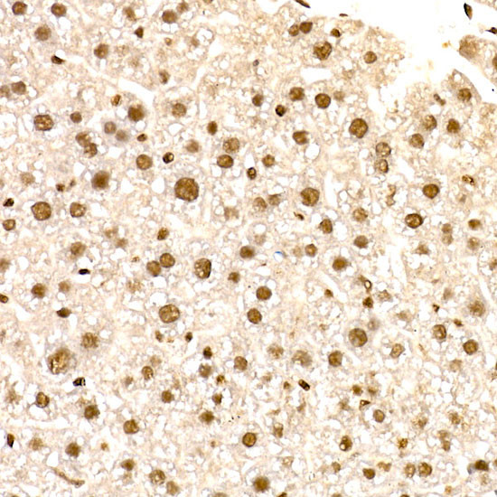 NR2F2 Antibody in Immunohistochemistry (Paraffin) (IHC (P))