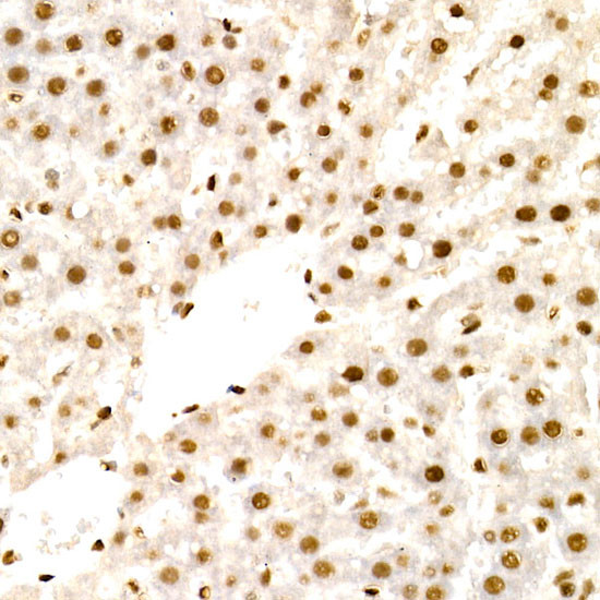 NR2F2 Antibody in Immunohistochemistry (Paraffin) (IHC (P))