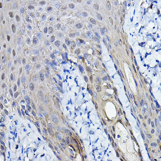 14-3-3 sigma Antibody in Immunohistochemistry (Paraffin) (IHC (P))