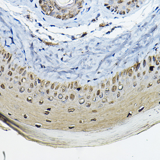 14-3-3 sigma Antibody in Immunohistochemistry (Paraffin) (IHC (P))