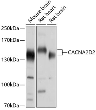 CACNA2D2 Antibody in Western Blot (WB)