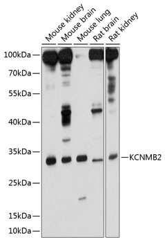 KCNMB2 Antibody in Western Blot (WB)