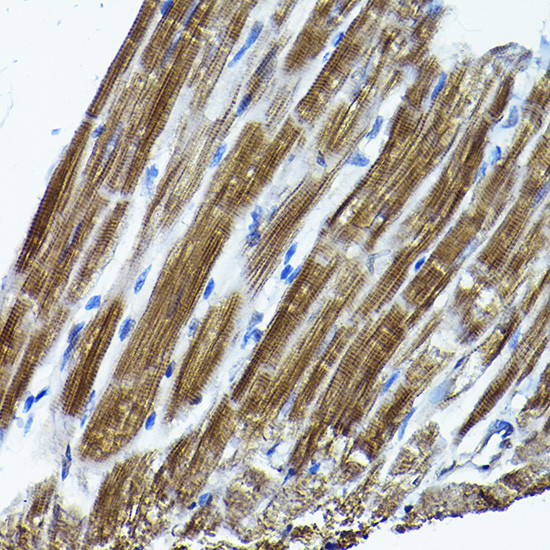 ICMT Antibody in Immunohistochemistry (Paraffin) (IHC (P))