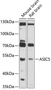 ASIC5 Antibody in Western Blot (WB)