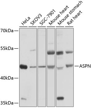 Asporin Antibody in Western Blot (WB)