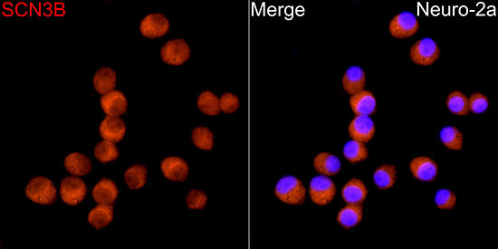 SCN3B Antibody in Immunocytochemistry (ICC/IF)