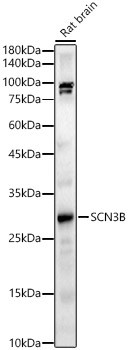 SCN3B Antibody in Western Blot (WB)