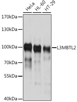 L3MBTL2 Antibody in Western Blot (WB)