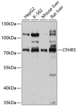 CFHR5 Antibody in Western Blot (WB)