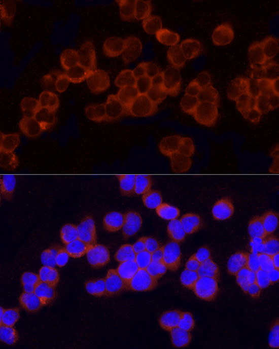 GCLC Antibody in Immunocytochemistry (ICC/IF)