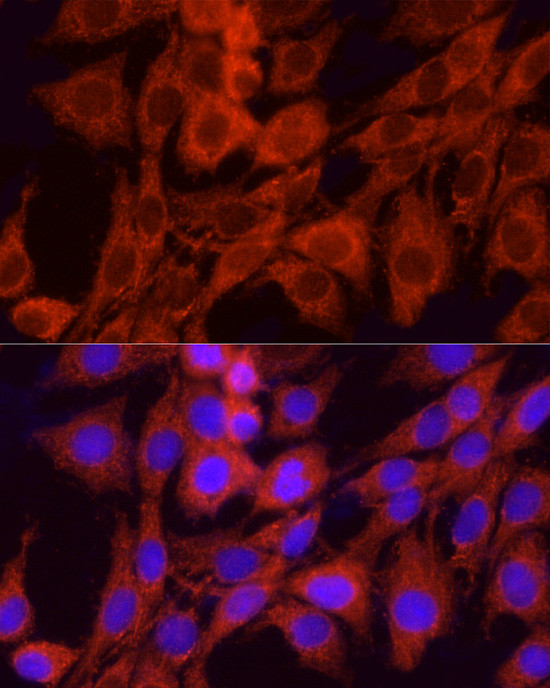 GCLC Antibody in Immunocytochemistry (ICC/IF)