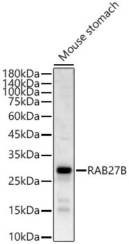 RAB27B Antibody in Western Blot (WB)