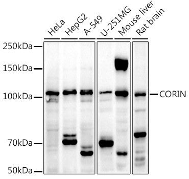 CORIN Antibody in Western Blot (WB)