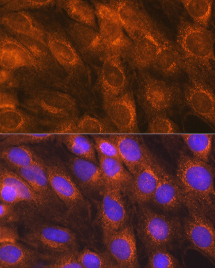 LMAN1 Antibody in Immunocytochemistry (ICC/IF)