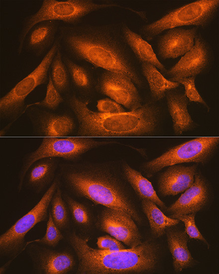 LMAN1 Antibody in Immunocytochemistry (ICC/IF)