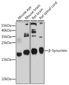 beta Synuclein Antibody in Western Blot (WB)