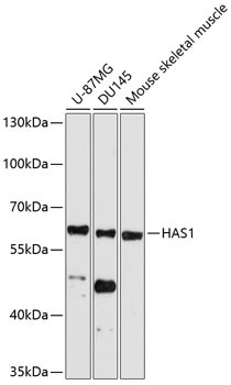 HAS1 Antibody in Western Blot (WB)