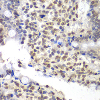 U2AF1 Antibody in Immunohistochemistry (Paraffin) (IHC (P))