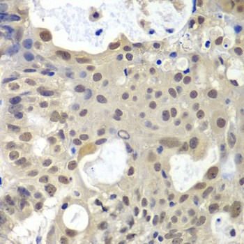 U2AF1 Antibody in Immunohistochemistry (Paraffin) (IHC (P))