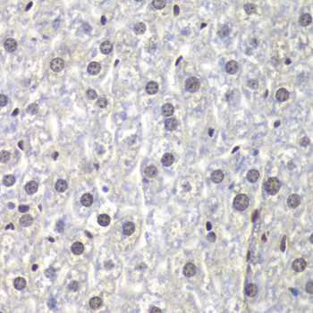 U2AF1 Antibody in Immunohistochemistry (Paraffin) (IHC (P))