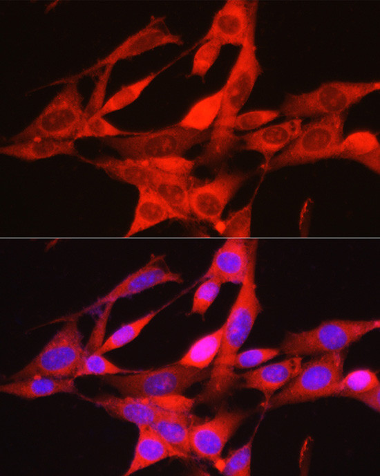 PHGDH Antibody in Immunocytochemistry (ICC/IF)