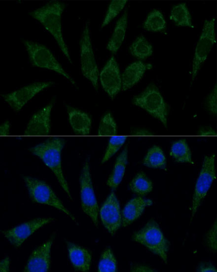 AKR1C2 Antibody in Immunocytochemistry (ICC/IF)