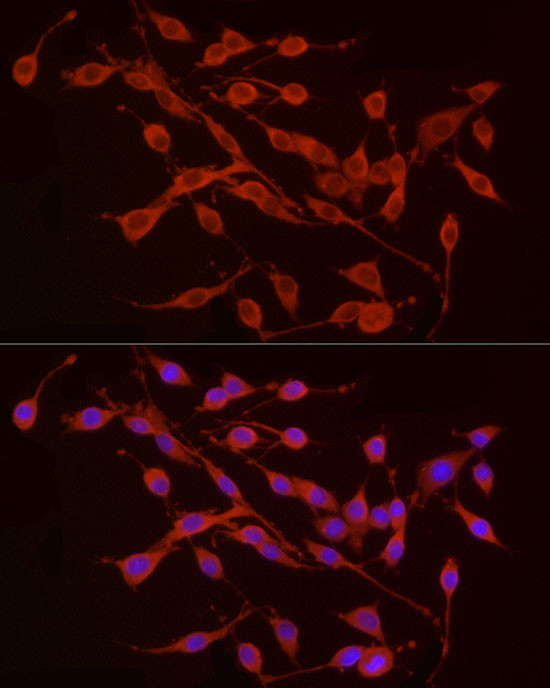 TREM2 Antibody in Immunocytochemistry (ICC/IF)