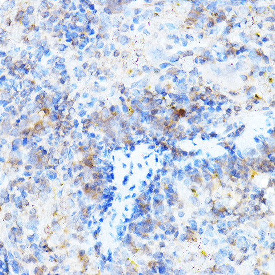 MULT1 (NKG2D Ligand) Antibody in Immunohistochemistry (Paraffin) (IHC (P))