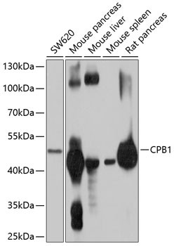 Carboxypeptidase B1 Antibody in Western Blot (WB)