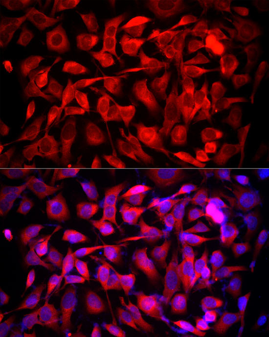 MTAP Antibody in Immunocytochemistry (ICC/IF)