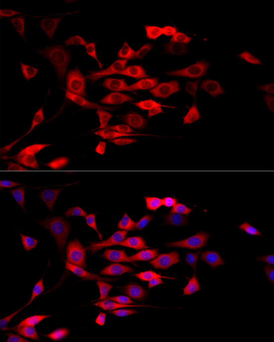 MTAP Antibody in Immunocytochemistry (ICC/IF)